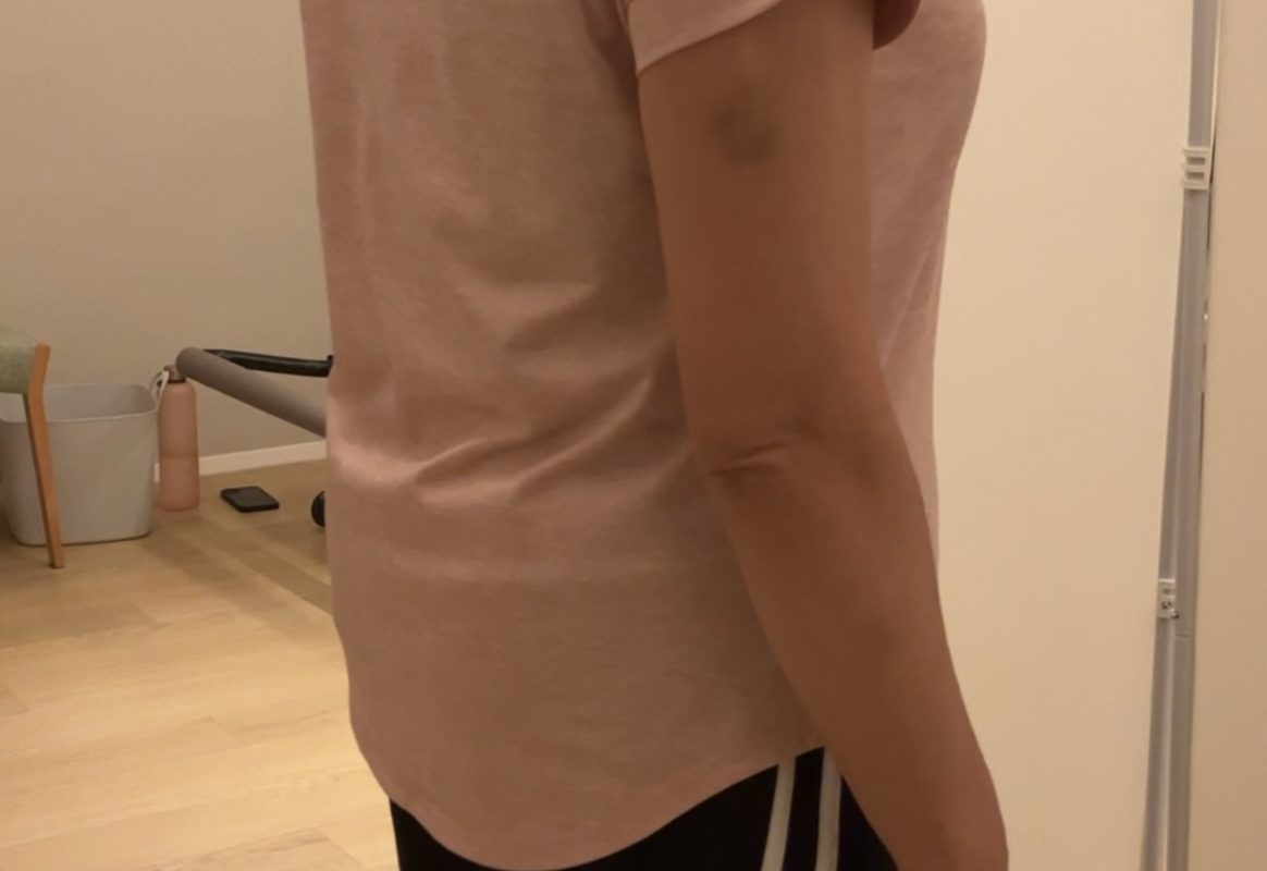 脚、腰の痛みと張り感を改善したい