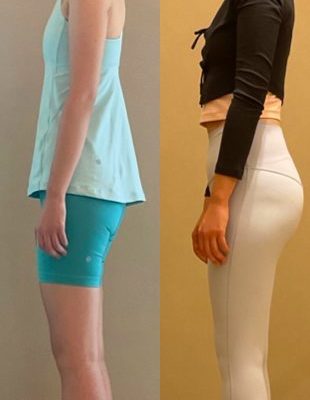 姿勢を改善し、軽やかな身体を手に入れたい