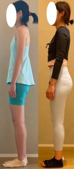 姿勢を改善し、軽やかな身体を手に入れたい