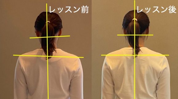 猫背を改善したい！顎と首のこりを解消したい！
