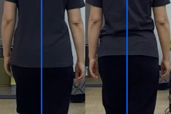 膝の痛みの再発防止、クラシックバレエを続けるための全身の強化　