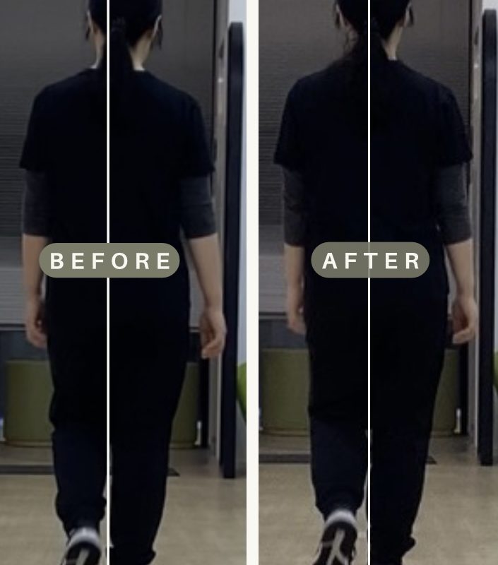 股関節の不調を改善し、運動習慣を身につけたい　